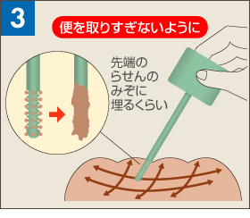 採便方法その１